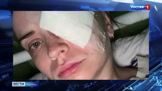 Пермячка, в которую стреляли из пневматики, рассказала подробности ЧП