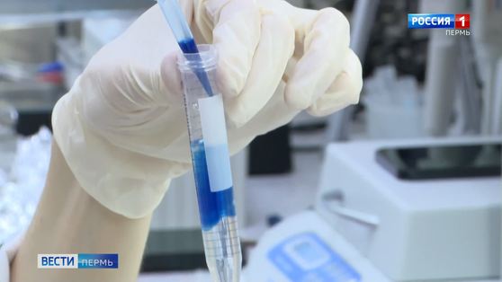 Пермские ученые разработали простую и дешевую тест-систему на антитела к коронавирусу